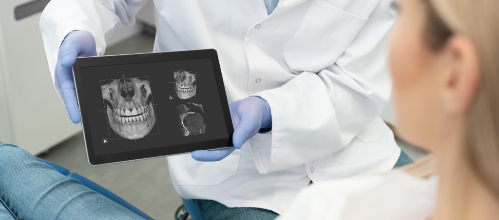 Dental Xray
