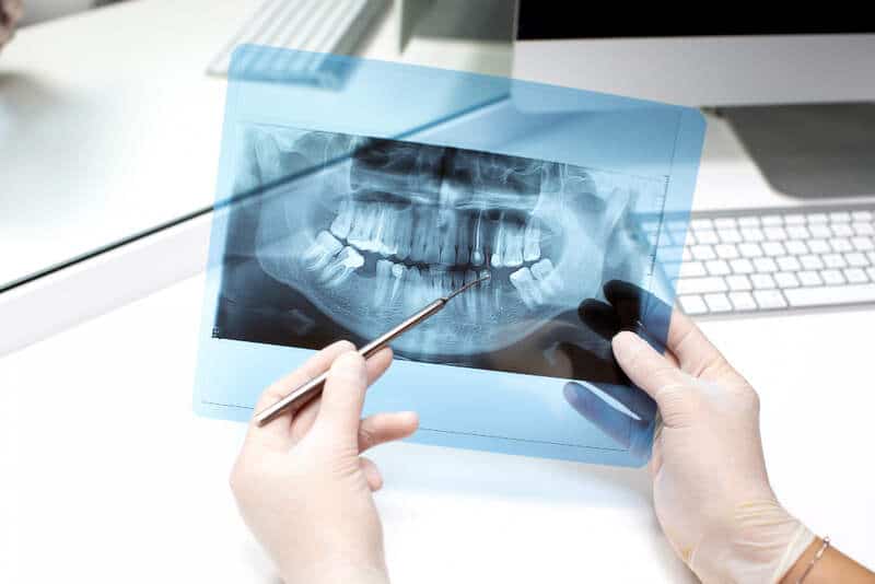 Dental X-rays in Newmarket