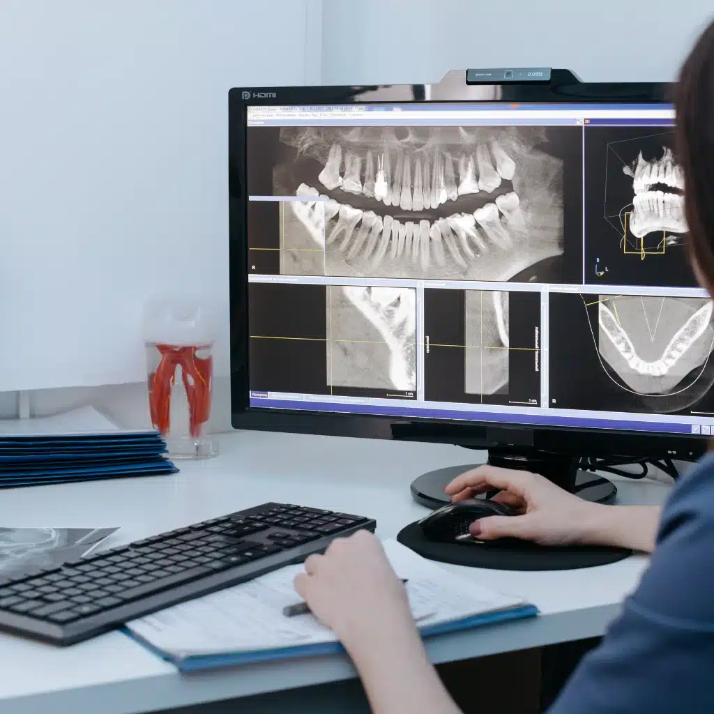 Digital Radiography