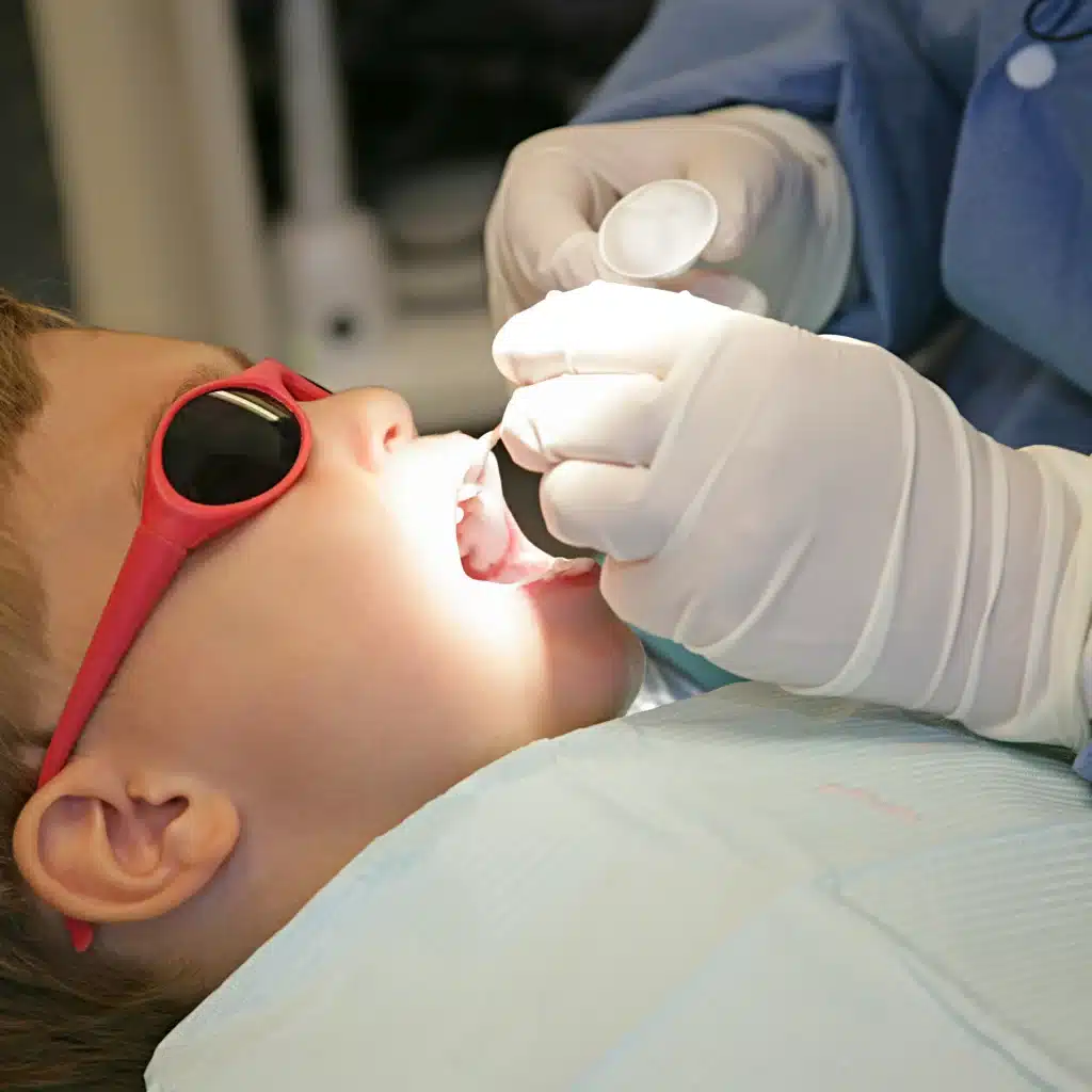 _Fluoride Treatments