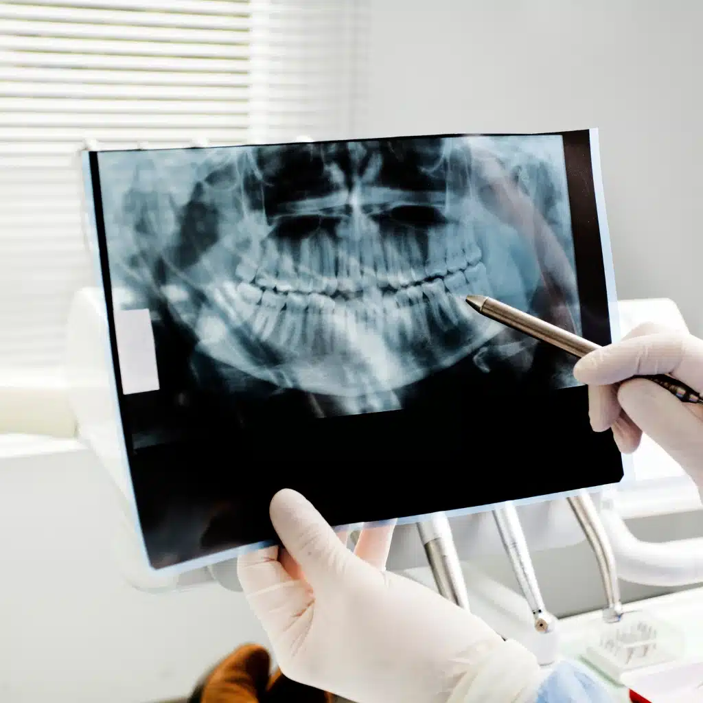 Oral Cancer Screening