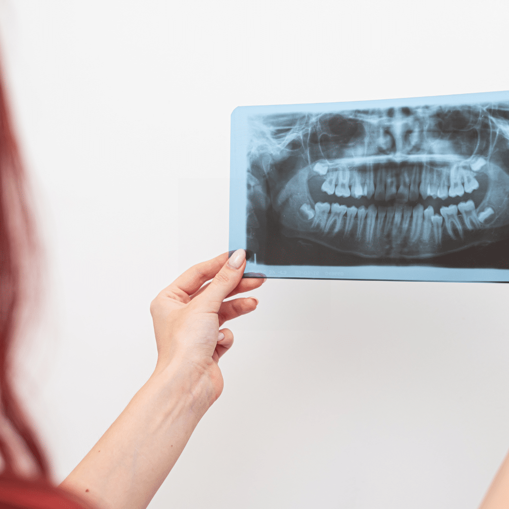 Panoramic radiography