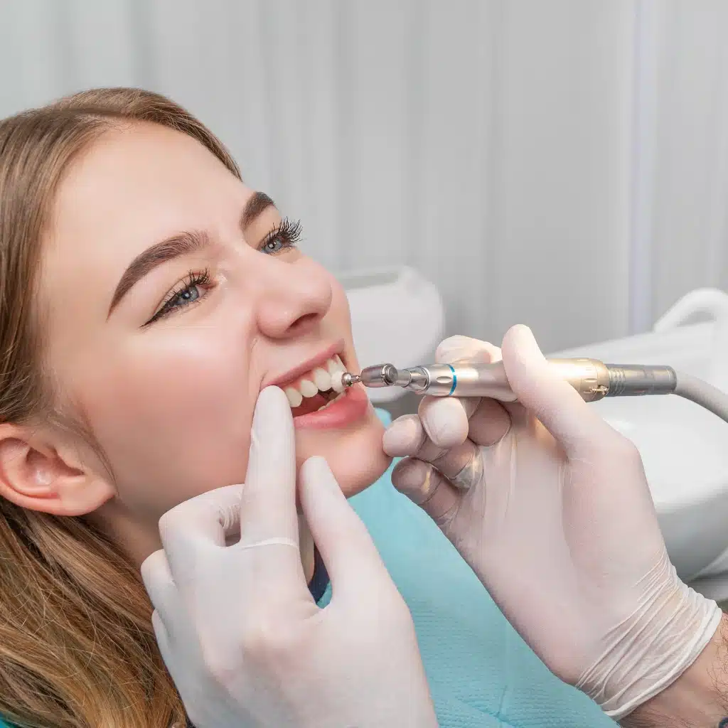 Teeth Polishing